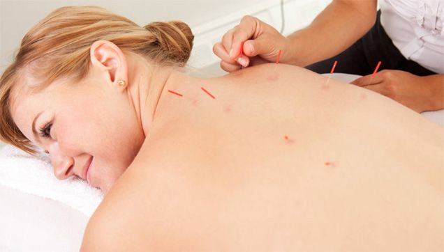 Géminis centro de estética y terapias complementarias S.L. mujer realizándose acupuntura en la espalda 